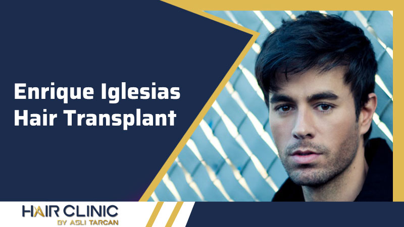 Enrique Iglesias Hair Transplant