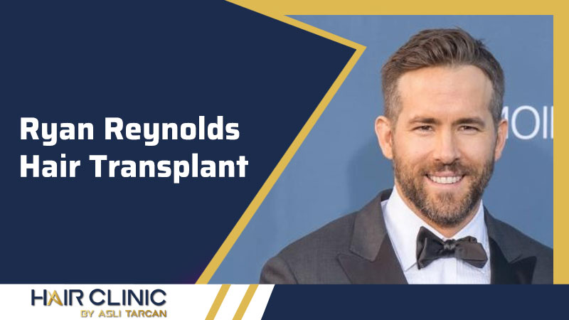 Ryan Reynolds Hair Transplant