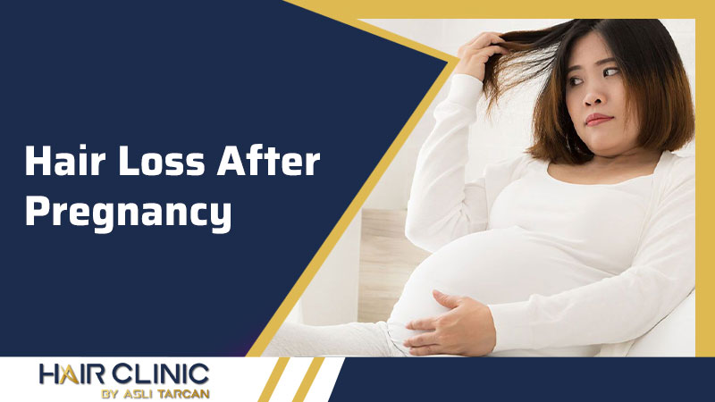 Hair Loss After Pregnancy