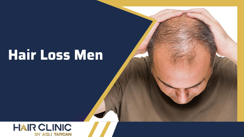 Hair Loss Men