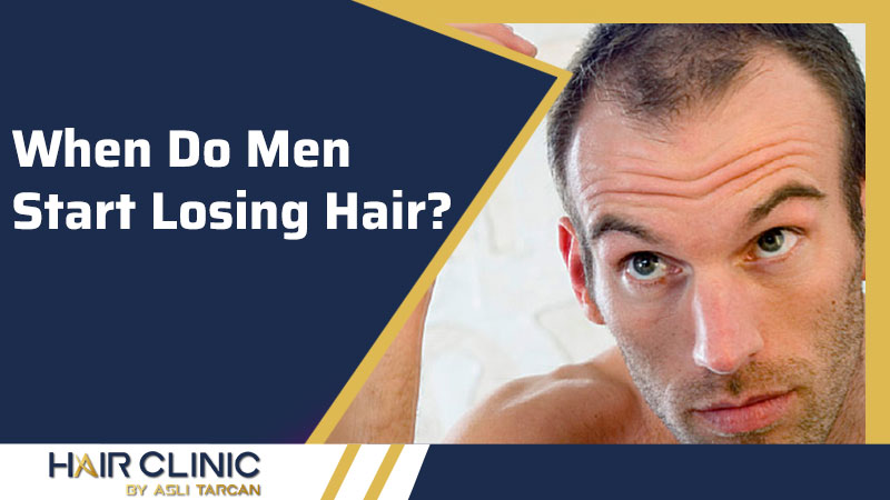 When Do Men Start Losing Hair?