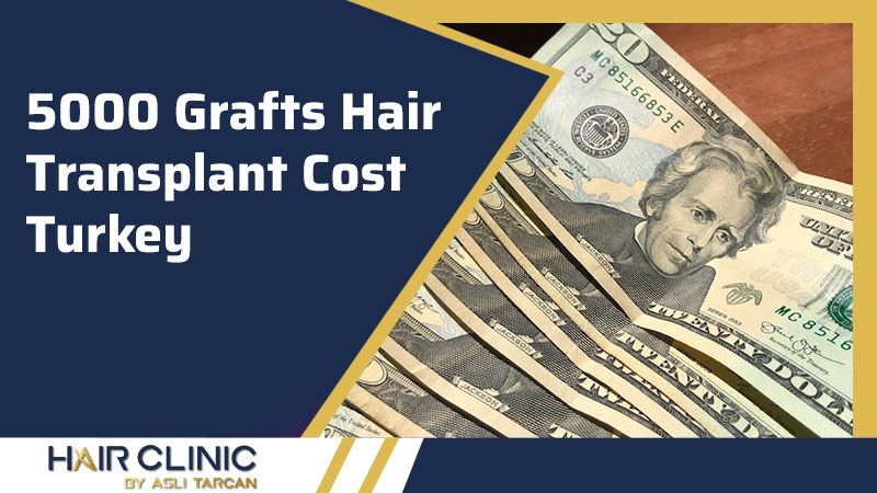5000 Grafts Hair Transplant Cost Turkey