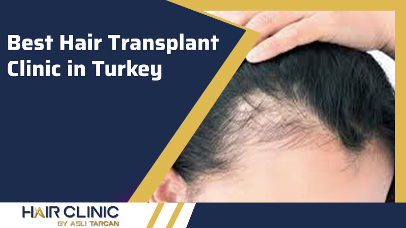 Best Hair Transplant Clinic In Turkey