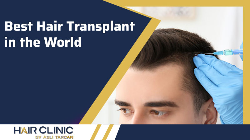 Best Hair Transplant In The World
