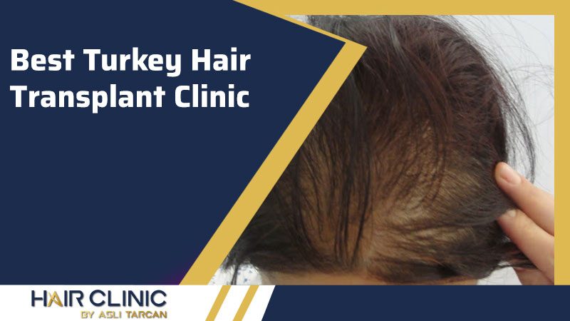 Best Turkey Hair Transplant Clinic