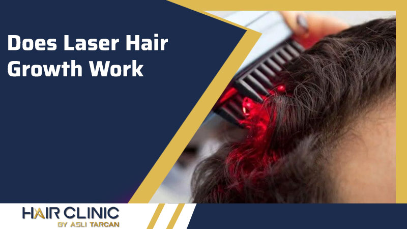 Does Laser Hair Growth Work?