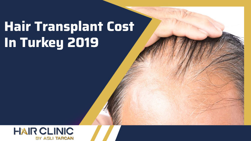 Hair Transplant Cost In Turkey 2019