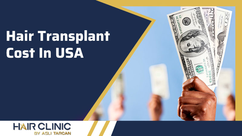 Hair Transplant Cost In USA